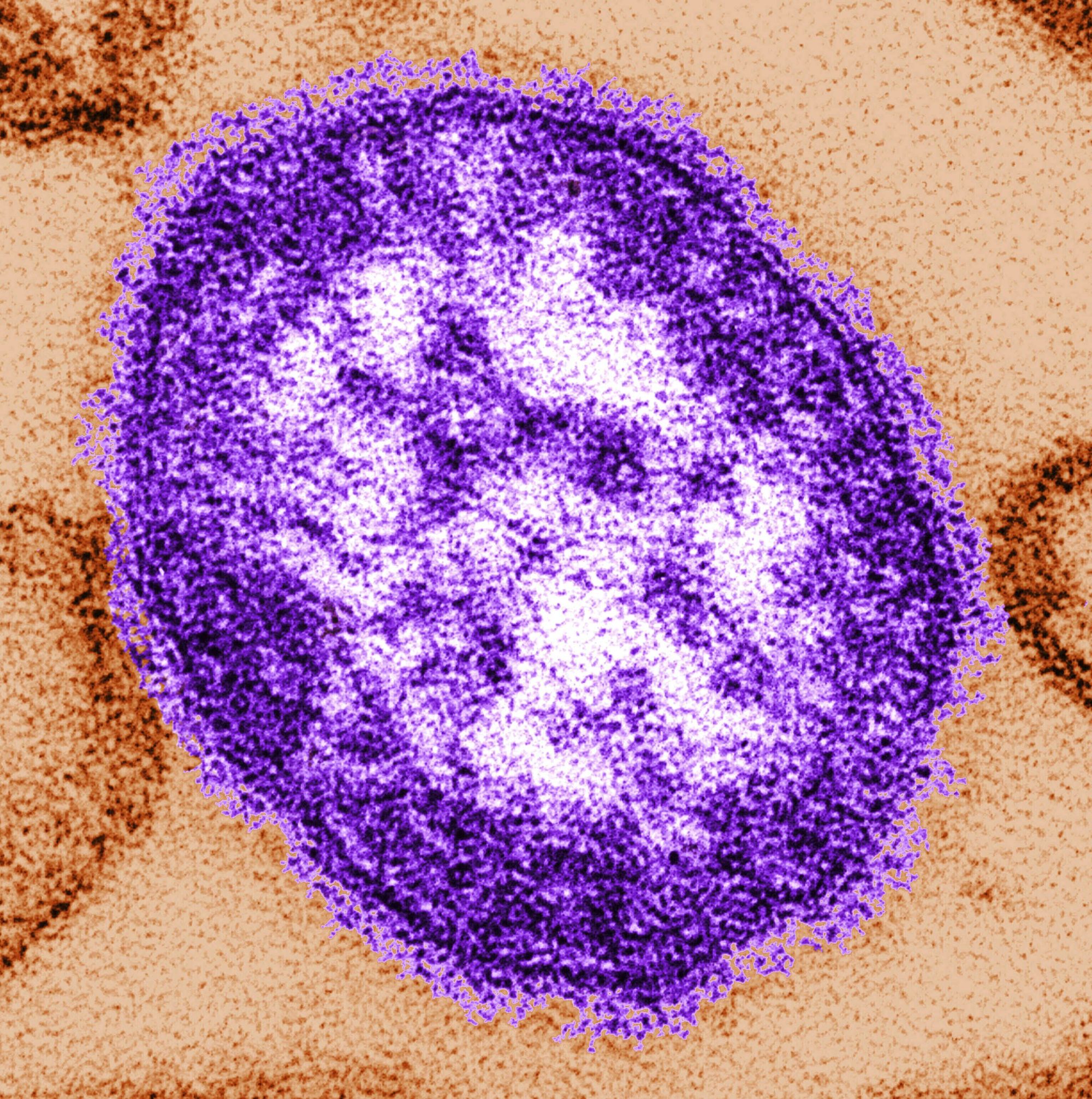 Gov. Kathy Hochul declares New York state of emergency over measles, Blick reports